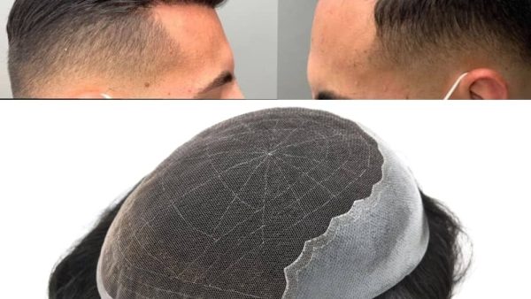 Mens Hair Systems